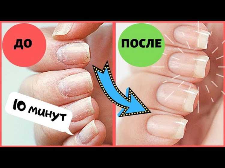 Рецепт для отращивания ногтей в домашних условиях